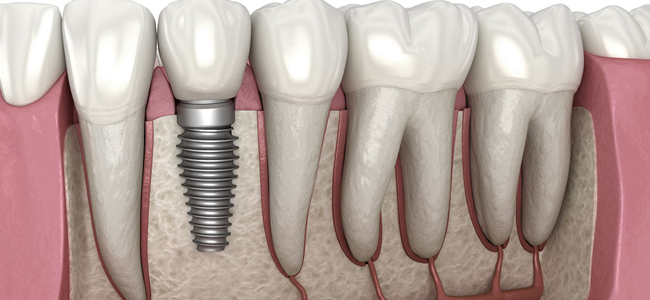 Dental Examination