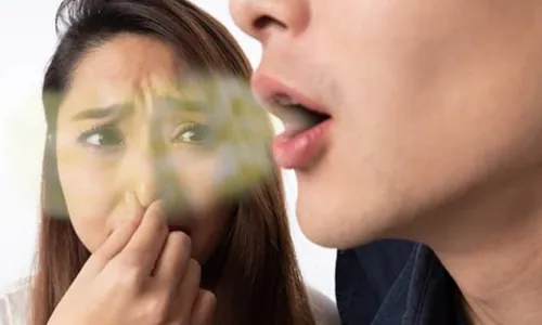 Bad Breath Treatment